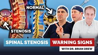 Spinal Stenosis: Heavy, Dead, Sore Legs. Spine Surgeon Explains