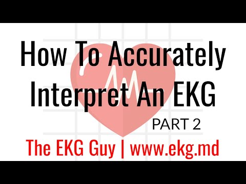 How to Accurately Interpret an EKG (Part 2) | The EKG Guy - www.ekg.md