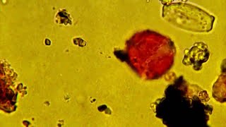 Bad allergies Here's how Houston health officials track pollen and allergy issues in our community