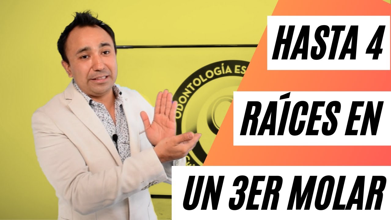Watch ¿Cuántas raíces tiene un 3er molar Esto pasa si no están derechas Now ¿Cuántas raíces tiene un 3er molar Esto pasa si no están derechas