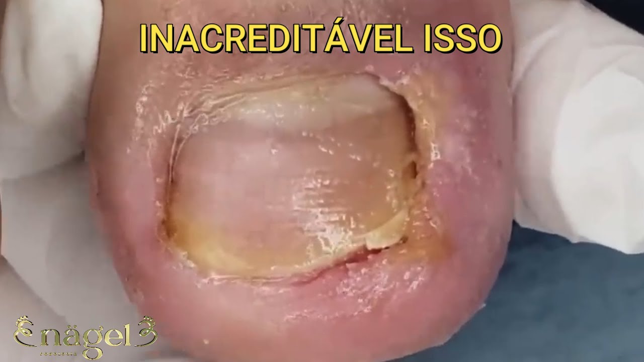 😱INACREDITÁVEL ESTE PROCEDIMENTO #satisfying #nails