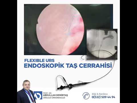 Kısa Video