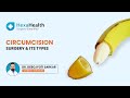 Is Circumcision A Major Surgery Types Of Circumcision Surgery HexaHealth Expert