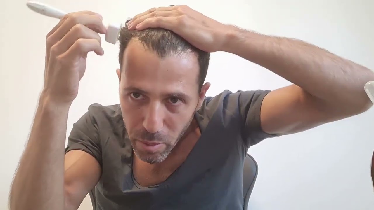 הוראות שימוש לדרמה סטאמפ / חותמת מחטים / מזותרפיה לשיער