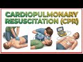 Cardiopulmonary Resuscitation CPR Simple Steps To Save A Life First Aid Training Video