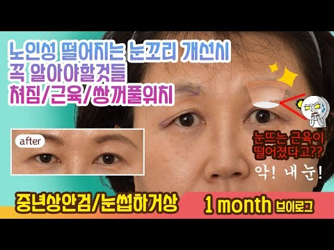 中年眼部 04