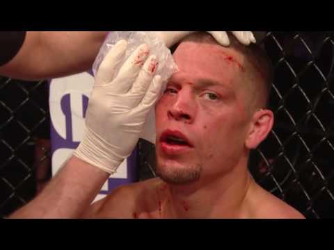 UFC 202 Free Fight  Conor McGregor vs Nate Diaz 1