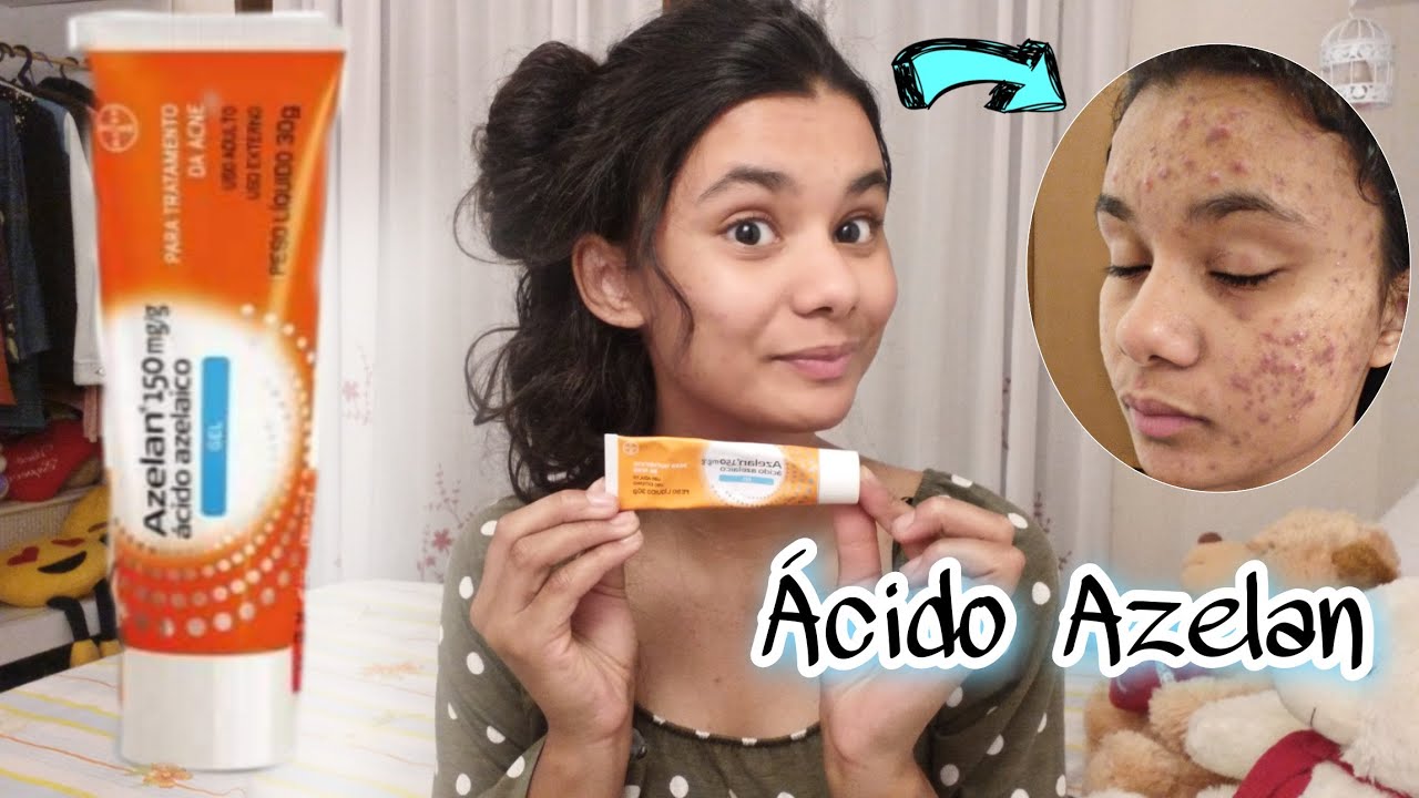 MINHA EXPERIÊNCIA COM ÁCIDO AZELAICO Azelan|Vanessa Marçal