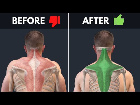 How To Un-F*ck Your Traps - Stop Endlessly Stretching & Try This!