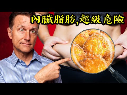 腹部脂肪,這種脂肪超危險,吃營養加快燃燒脂肪,,自然療法,柏格醫生 Dr Berg (腹部脂肪,這種脂肪超危險,吃營養加快燃燒脂肪,,自然療法,柏格醫生 Dr Berg)