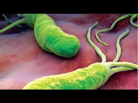 Che si riferisce alla colonna cervicale Dolore nel basso addome e parte bassa della schiena durante la gravidanza 38 settimane
