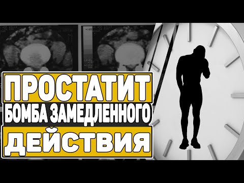 Лікування простатиту цибулею