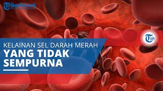 Mielodisplasia, Kelainan yang Disebabkan Sel Darah Terbentuk secara Tak Sempurna atau Disfungsional