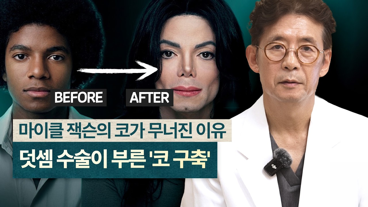 코끝이 들리고 딱딱해진다면? 구축코가 시작되는 신호와 재수술 원칙 썸네일