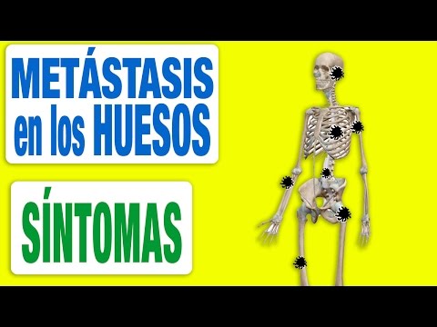 Trattamento della prostata di acqua viva e morta Prostatilen parte del prezzo