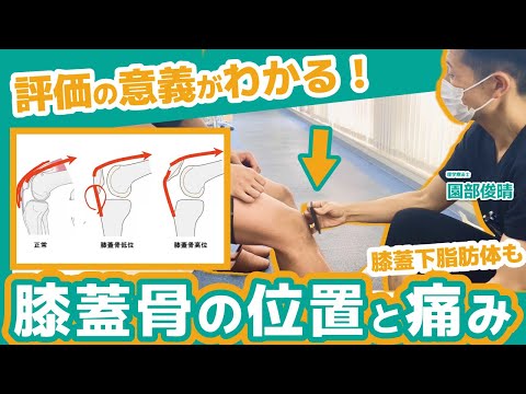 ガリシアの尋常性膝蓋骨