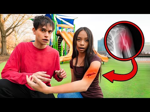 Our Little Sister Almost Lost Her ARM!