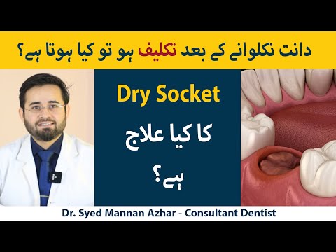 What Are The Causes Of Dry Socket? (Urdu/Hindi) | Daant Nikalwany Ke Baad Dry Socket Q Hojati Hy?