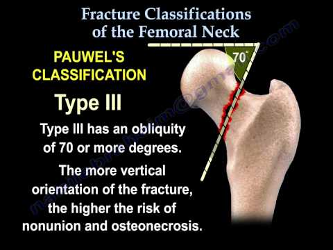 Simptomele și tratamentul articulațiilor piciorului