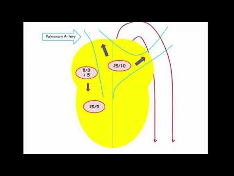 12DaysinMarch, Pulmonary Vascular Disease, Part 1 - Background for USMLE Step One