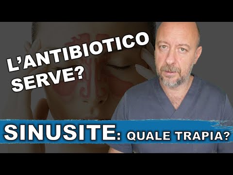 SINUSITE che non passa con ANTIBIOTICO???