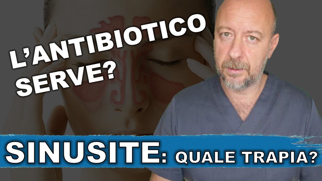Watch Now SINUSITE che non passa con ANTIBIOTICO SINUSITE che non passa con ANTIBIOTICO