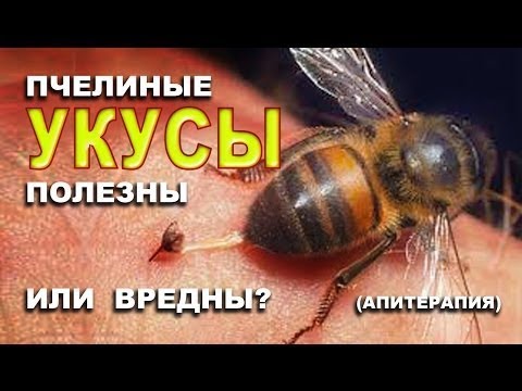 Болит шея при поворотах головы Способы лечения болезней суставов