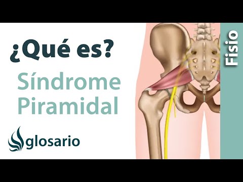 SÍNDROME DEL PIRAMIDAL | ¿Qué es?