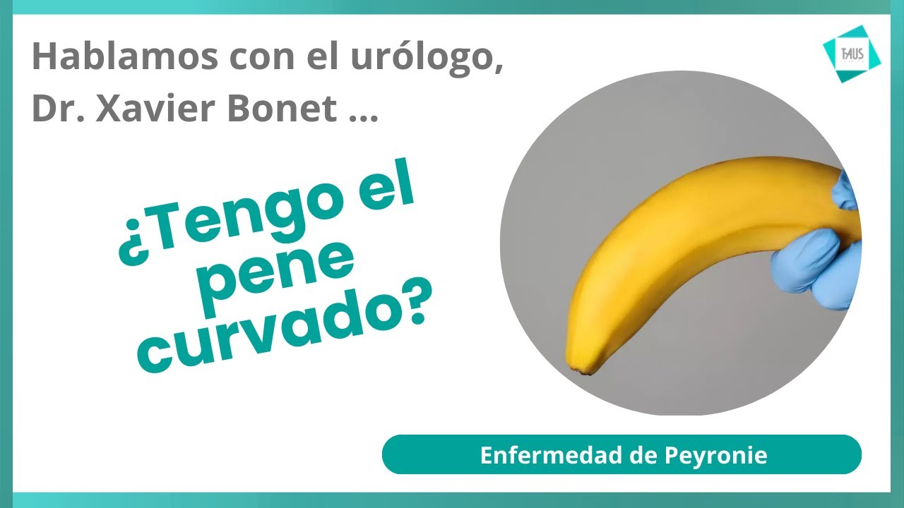 Xavier Bonet Puntí-30