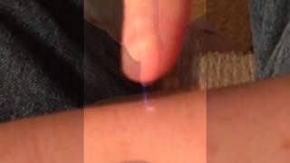 Static electricity when you shock someone