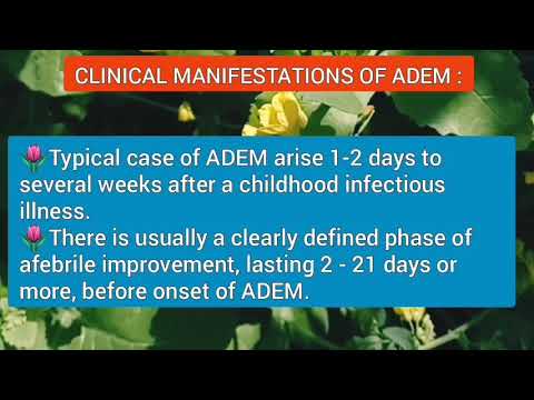 ADEM, Acute Disseminated Encephalomyelitis, MRI, Criteria, Symptoms, & Treatment