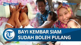 ALHAMDULILLAH! Bayi Kembar Siam di Malang Sudah Boleh Pulang Pasca-operasi Pemisahan