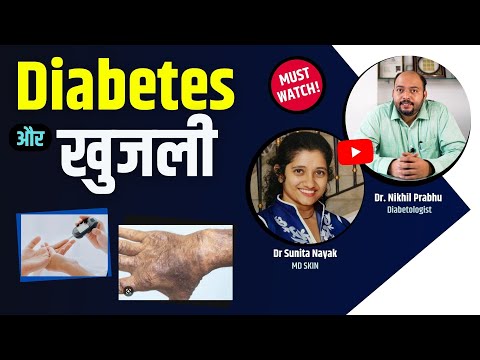 डायबिटीज और खुजली | डायबिटीज में स्किन इन्फेक्शन | डायबिटीज,खुजली | खुजली का इलाज |