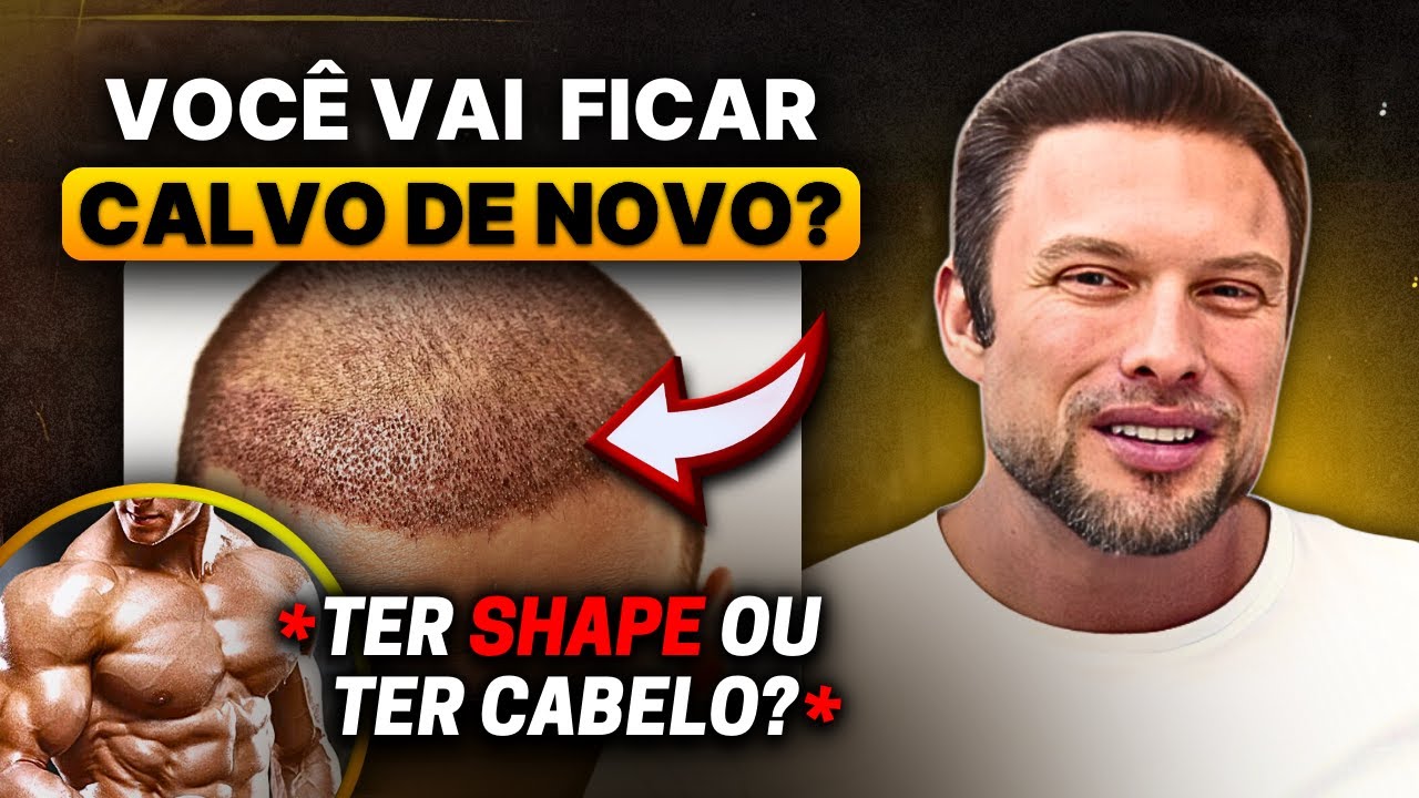 IMPLANTE CAPILAR e ANABOLIZANTE: O Cabelo VAI CAIR de Novo? | Muzy Explica