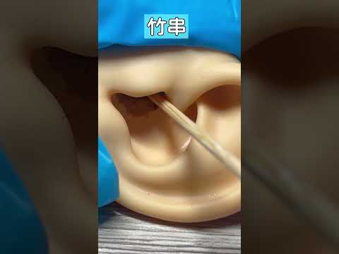 適切な耳掃除:多くの人はこれにさえ注意を払っていません