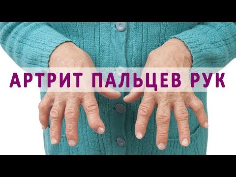 Боль в коленях при сгибании спины Ушиб голеностопного сустава лечение народные средства