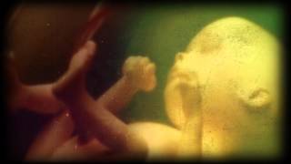 DEAD WHEN I FOUND HER ~Threadbare [Preview]