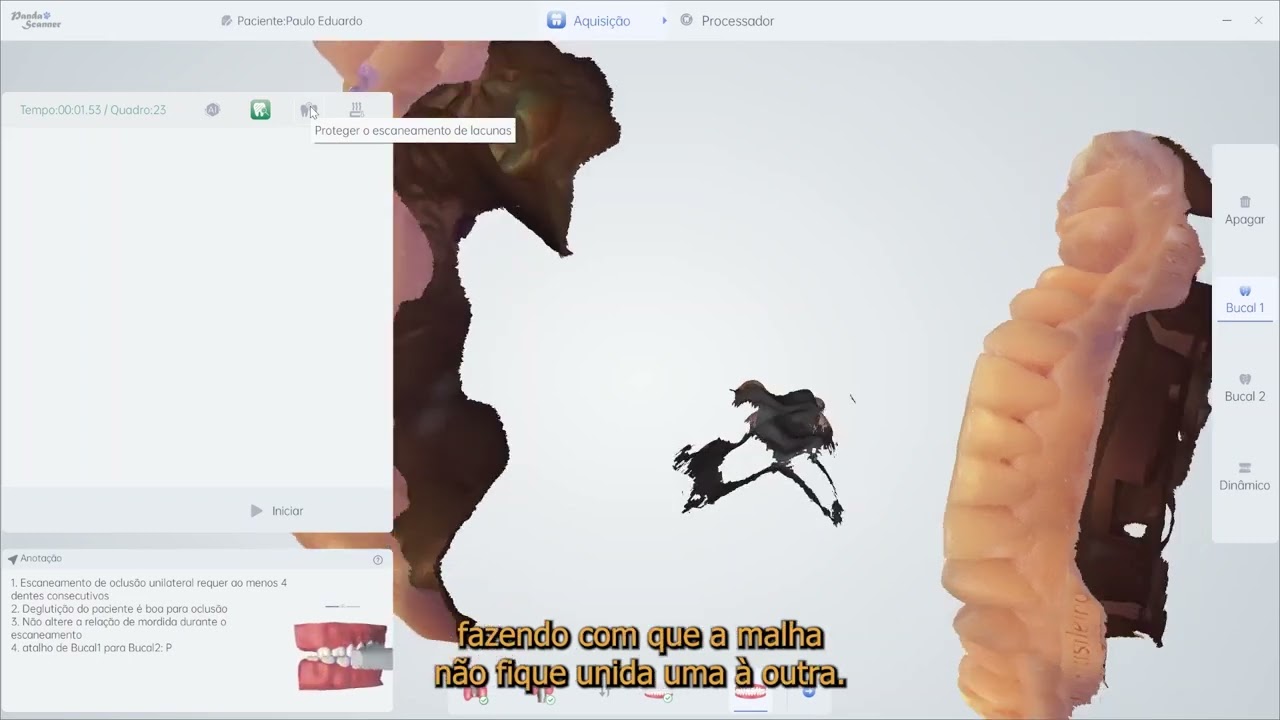 Vídeo 22 - Ferramentas úteis durante o escaneamento
