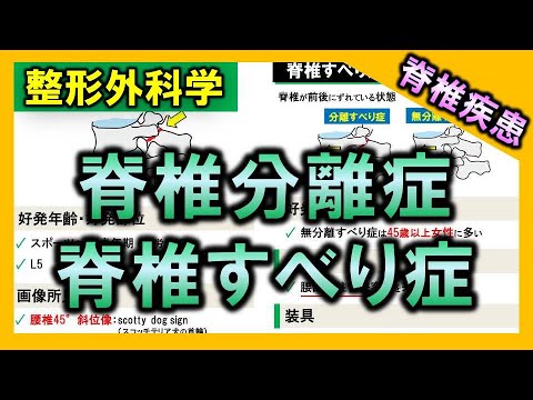 脊椎すべり症について詳しく解説