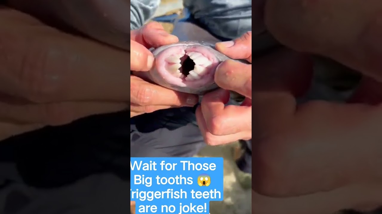 Wait for Those Big tooths 😱Triggerfish teeth are no joke!