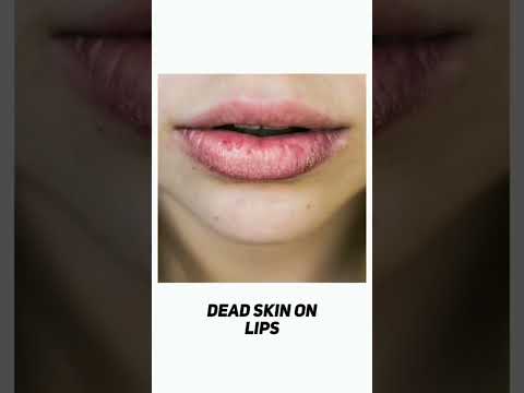 big problem small solution||#hashtags#skincare #glowuptips#hairstyle#hashtagsforyoutube#glowupgoals