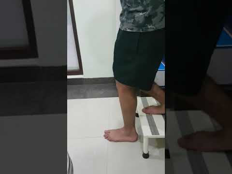 Hybrid ACL (Knee Ligament) patient 6 weeks after surgery