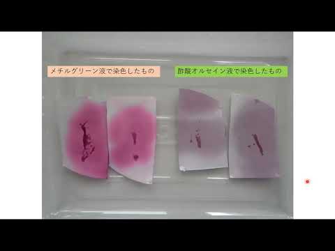 DNA・RNAって知っていますか？タマネギで存在を調べてみましょう！
