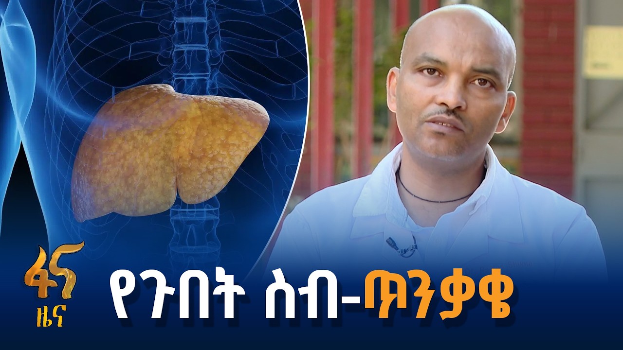 የጉበት ስብ ክምችት መንስዔና ሕክምና