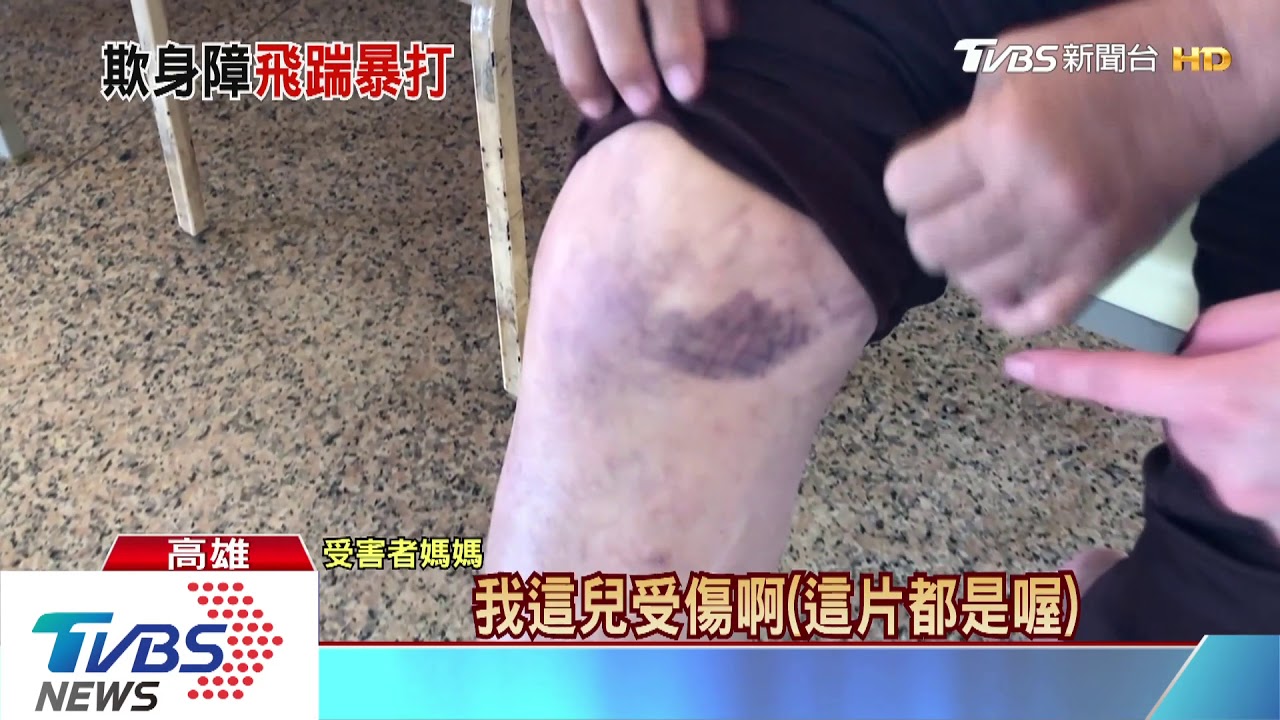 凶殘!眾目睽睽下 男子暴打狂踢多重障礙兒