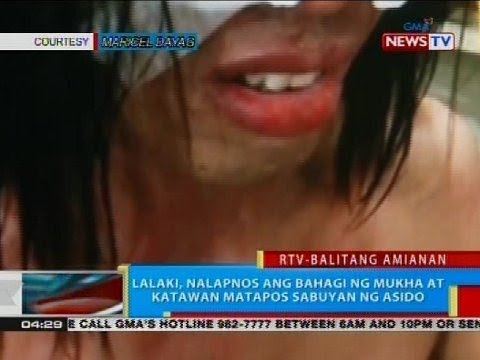 Ginger katotohanan tungkol sa pagbaba ng timbang Mawalan ng timbang hugas enemas