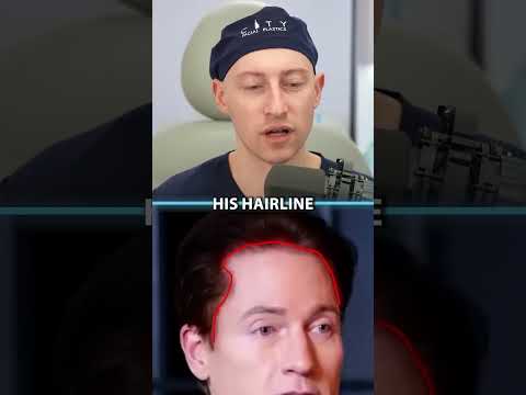Hair Surgeon Reacts To Bryan Johnson Reveals How He Reverses Hair Loss