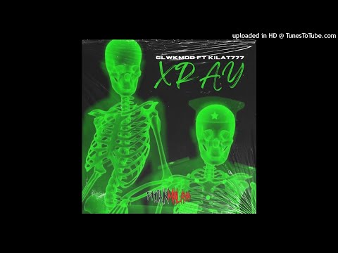 GLWKMOD X KILAT777 - XRAY