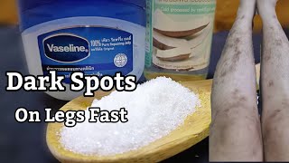 How To Remove Dark Spots On Legs Scar Mosquito Bites, Hyperpigmentation With Vaseline On Legs Fast