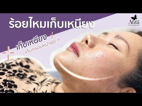 ร้อยไหม